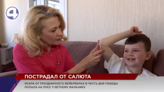 Во время праздничного салюта искра обожгла руку 7-летнего мальчика Во время праздничного салюта искра обожгла руку 7-летнего мальчика