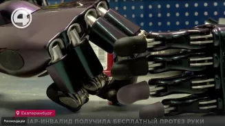 Повар-инвалид получила бесплатный протез руки Повар-инвалид получила бесплатный протез руки