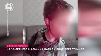 На 10-летнего мальчика напали двое сверстников На 10-летнего мальчика напали двое сверстников