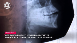 Без зубов и денег: мужчина пытается привлечь к ответственности обидчиков Без зубов и денег: мужчина пытается привлечь к ответственности обидчиков
