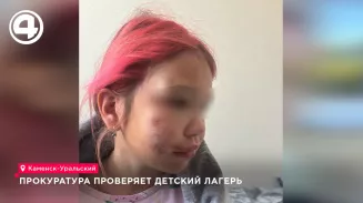 Прокуратура проверяет детский лагерь, где травмировался ребёнок