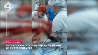 Уральские онкологи удалили 60-килограммовую опухоль