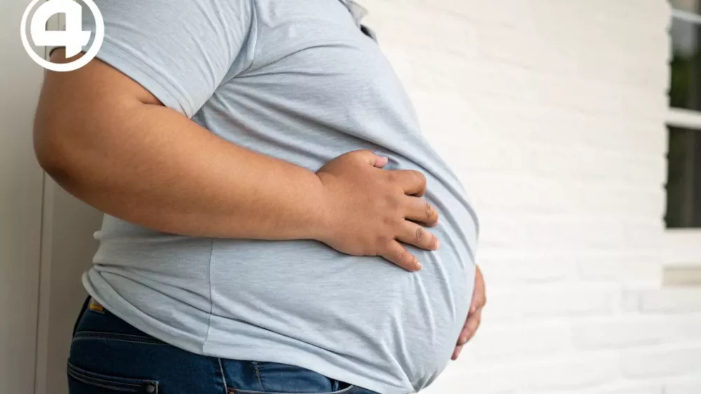 Бариатрический хирург: «Ожирение в России выросло на 52% за 5 лет»