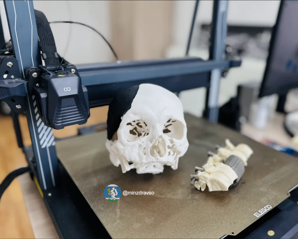 3D-модели черепов и позвоночников пациентов печатают нейрохирурги госпиталя для ветеранов войн 3D-модели черепов и позвоночников пациентов печатают нейрохирурги госпиталя для ветеранов войн